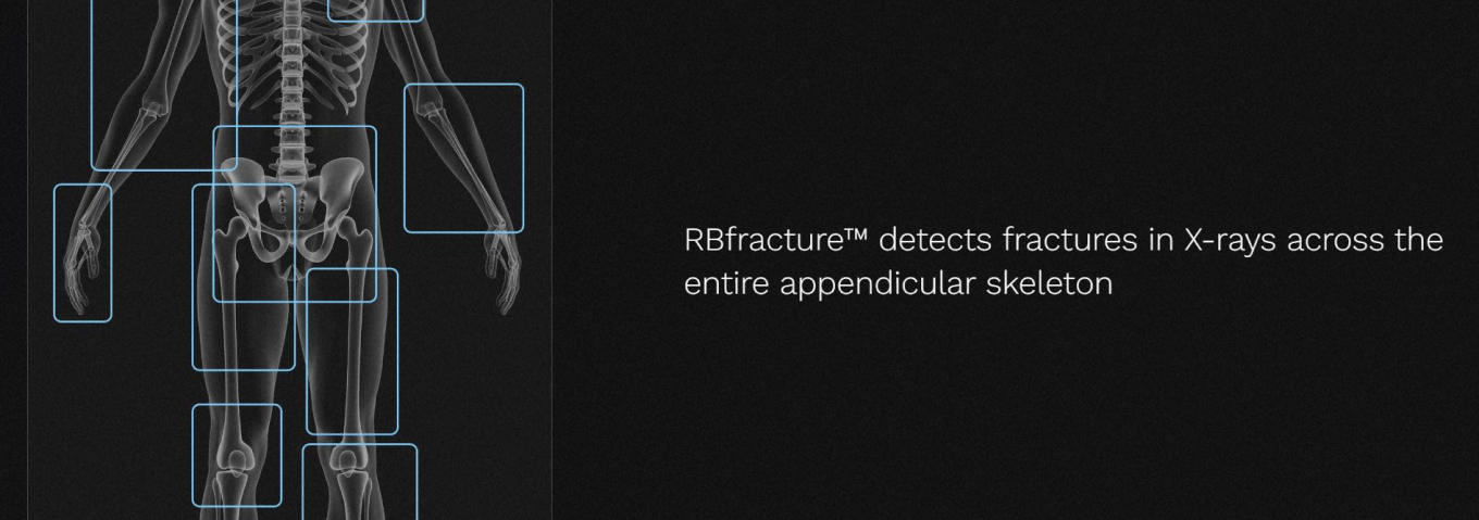 RBfracture™