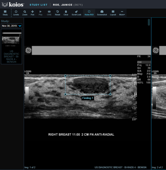 https://testdynamics.net/wp-content/uploads/2023/09/DS-Thyroid_Algorithm_Ultrasound.jpg
