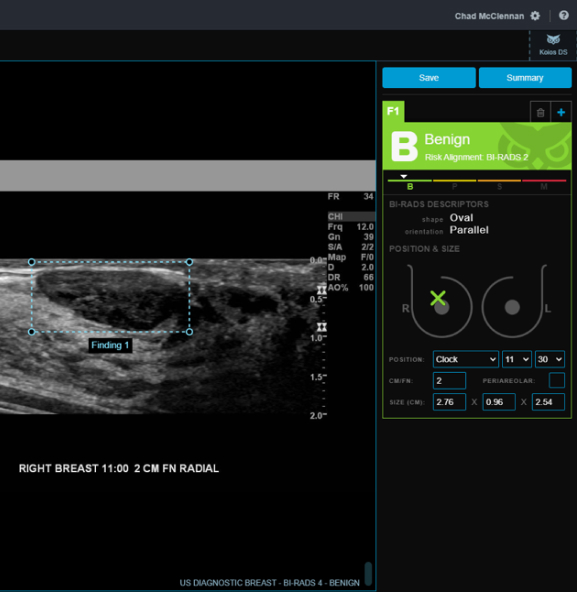 https://testdynamics.net/wp-content/uploads/2023/09/DS-Thyroid_Algorithm_Ultrasound2.jpg
