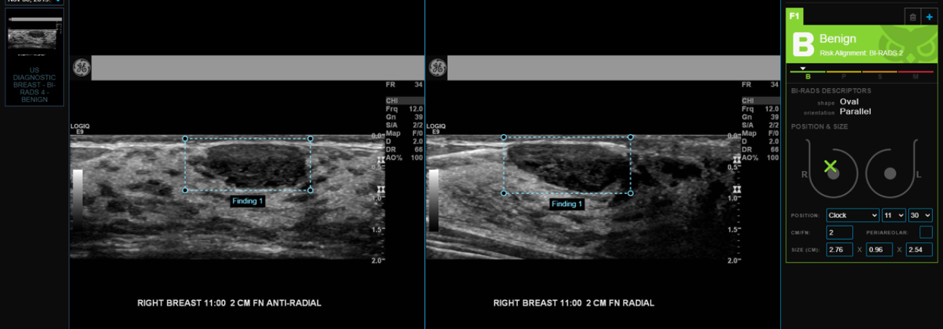 DS™ Thyroid