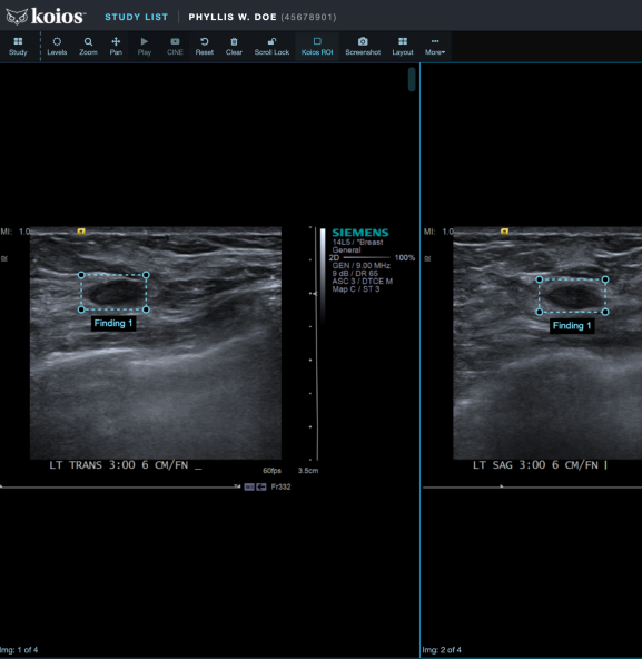https://testdynamics.net/wp-content/uploads/2023/09/DS-Thyroid_Algorithm_Ultrasound4.jpg