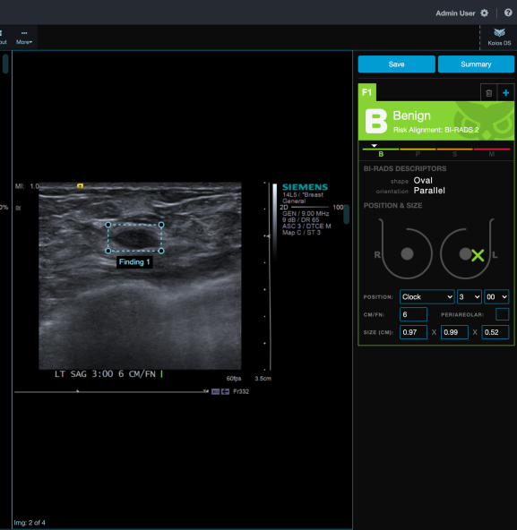 https://testdynamics.net/wp-content/uploads/2023/09/DS-Thyroid_Algorithm_Ultrasound5.jpg