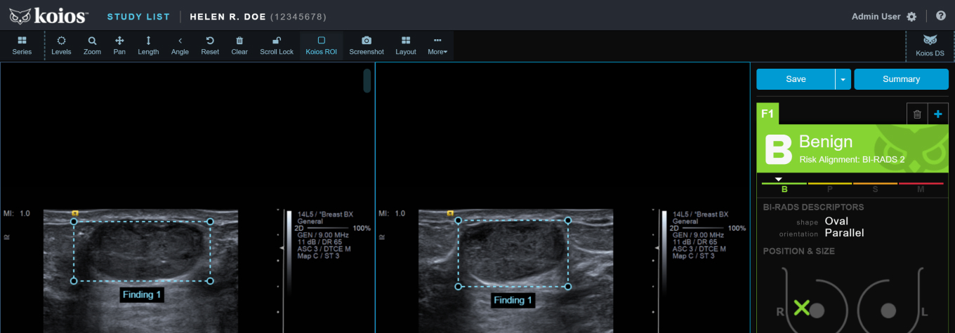 DS™ Breast